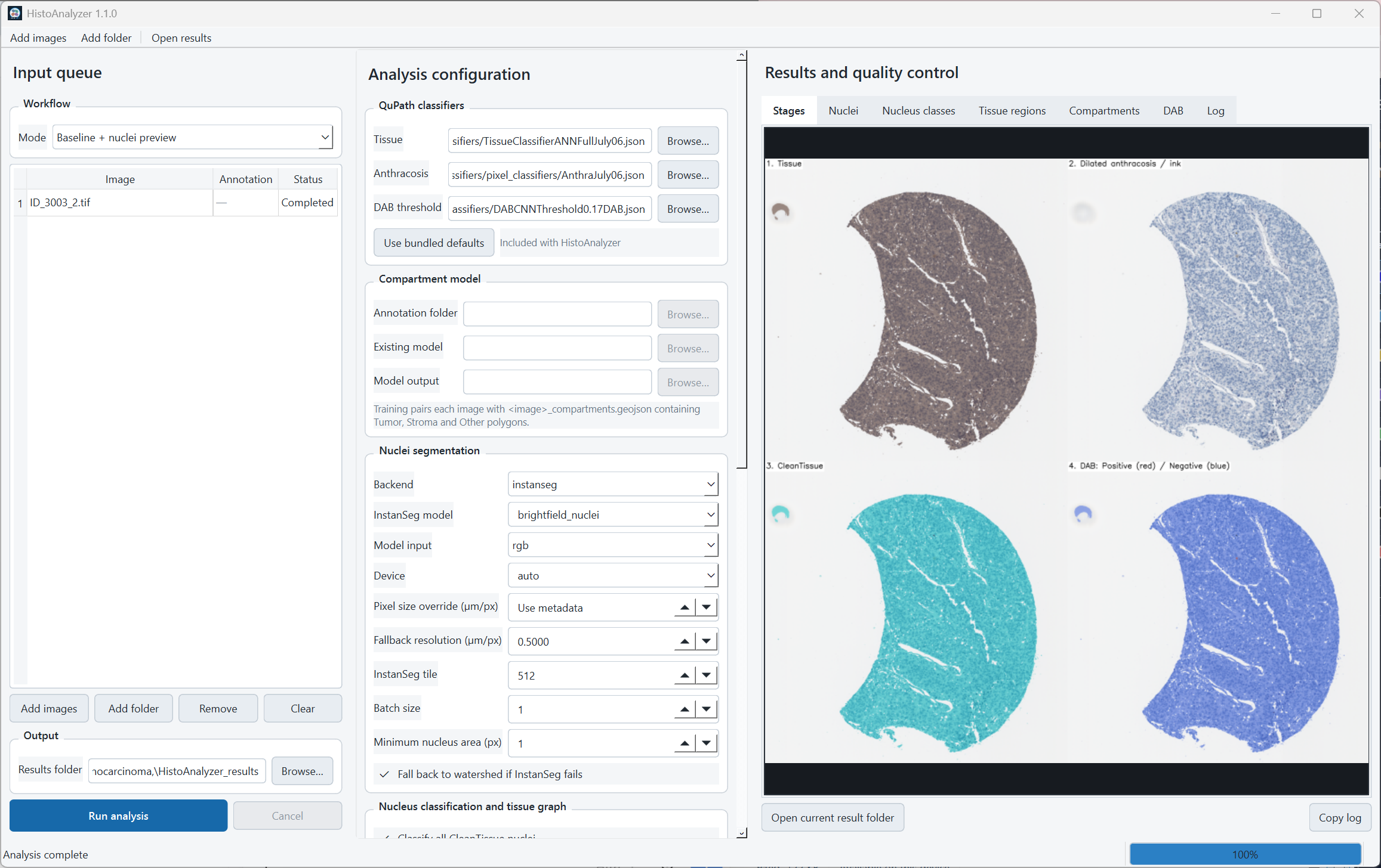 HistoAnalyzer user interface